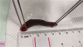 驚！常喝山泉水　5公分水蛭藏鼻內、男鼻血流不停（圖／長安醫院提供）