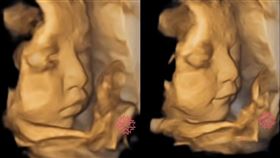 「寶寶在肚子裡打開眼睛、笑了」　7秒片吸萬讚。「蘇怡寧醫師愛碎念」臉書粉專