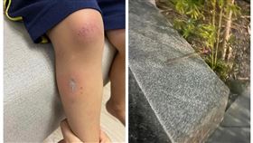 高雄,岡山,公園,香,燙傷