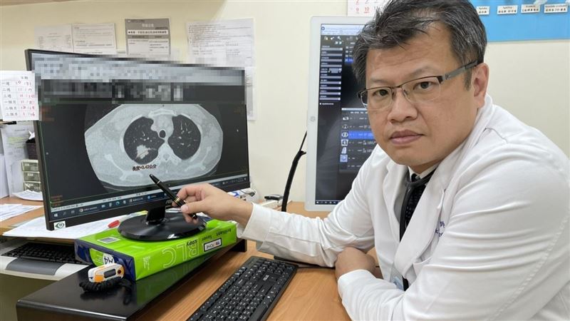 大同醫院LDCT篩出不菸也罹肺癌