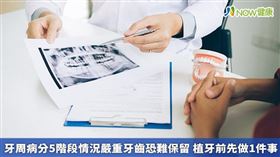 名家/徐慶雲醫師提醒，牙周病治療完後應3個月回診1次，待牙周病狀況穩定後，半年回診洗牙即可。（勿用）