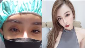 事隔3個月雪碧竟又再度到醫院動手術。（圖／翻攝自真雪碧 無雙ss臉書）