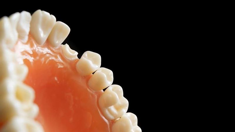 「缺牙」不會死人　研究：但可能折壽