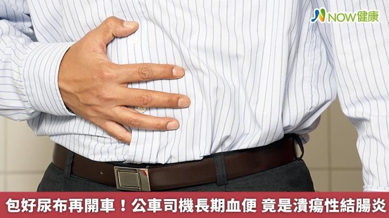 公車司機長期血便　竟是潰瘍性結腸炎