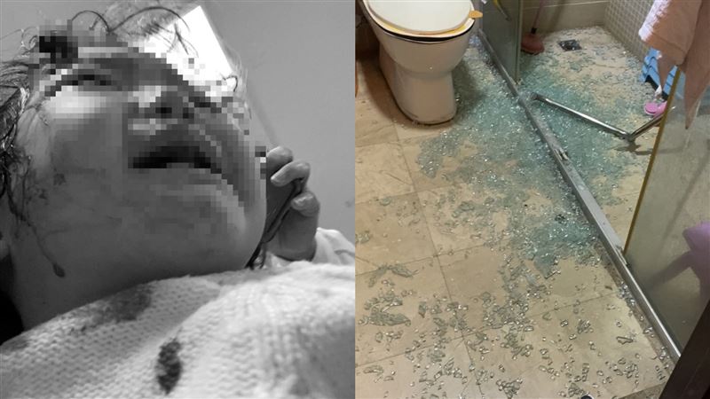 女星怒PO酒店玻璃炸裂　女兒滿臉血網嚇壞