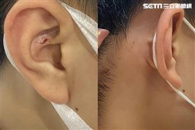 課堂嬉鬧遭師揪耳朵　母提精神賠償到65歲（圖／翻攝爆料公社）