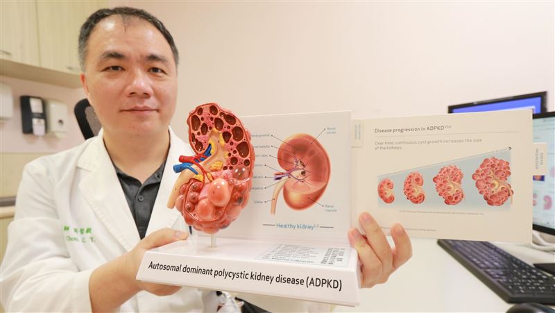 退伍蛙人因這病腎臟腫成3倍　如一串葡萄