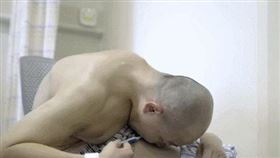 李華,摺疊人,僵直性脊椎炎,手術,180度彎曲