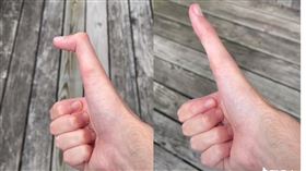 海賊王，魯夫真人版，雅各，伸縮自如的大拇指，超長 (圖／翻攝自抖音)