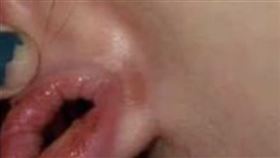 耳洞 感染
https://twitter.com/kubilivepost/status/1431178533884383233