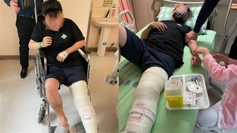 警高層招待所影片是他外流？斷腿男回應了