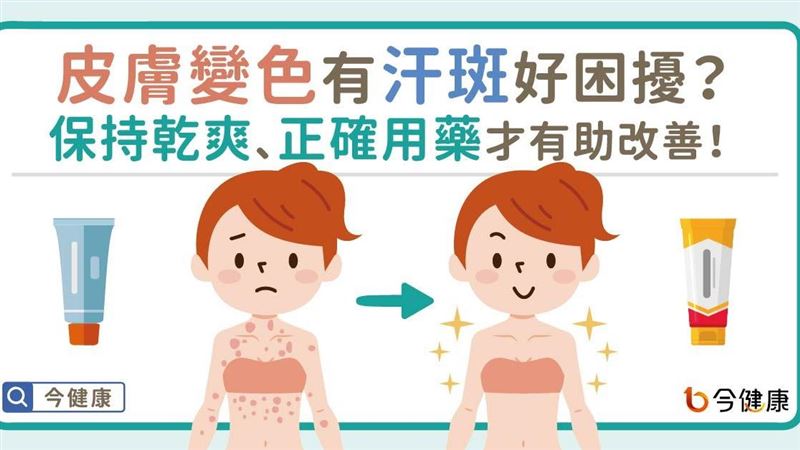 皮膚變色有汗斑？保持乾爽正確用藥才有效