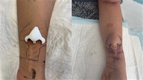 （圖／翻攝自CHU de Toulouse 臉書）