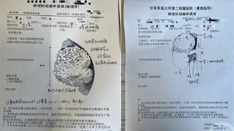 被醫學耽誤的插畫家　手繪病理申請單暴紅