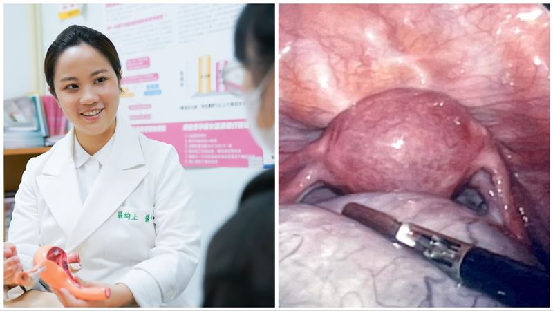 妙齡女劇烈腹痛　體內赫見「頭髮、牙齒」