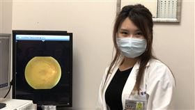 1115眼中風(書田診所提供)