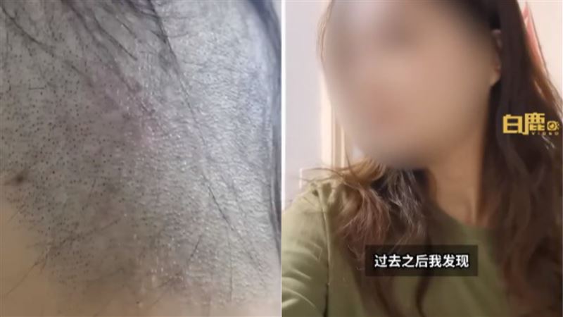 當髮型模特兒！22歲女後腦頭髮慘被剃光