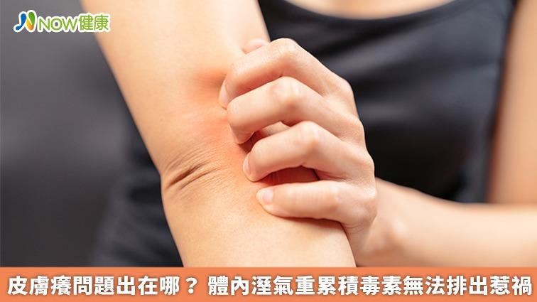 皮膚癢問題出在哪？ 溼氣累積毒素惹禍