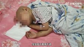安徽，4歲女童萌萌，神經母細胞瘤第四期，復發，化療，(圖／翻攝自猛獁新聞微博)