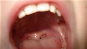 口腔（圖／翻攝自pixabay）