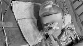 台中清水區，1歲女童，小桃子，保母家，昏迷，顱內出血，2度手術恐成植物人，新舊傷，媽媽控訴 (圖／翻攝畫面)