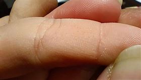 小孩，玩竹子刺傷手，滿手扎滿黑色小細毛，(圖／翻攝自爆系知識家)