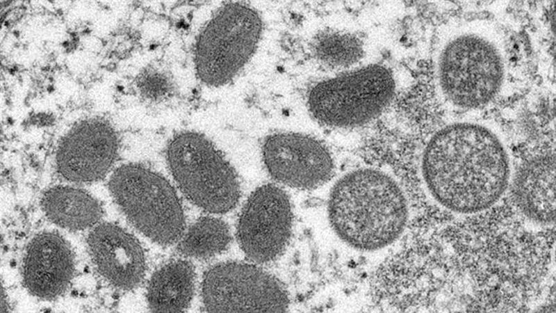 世衛擬將猴痘改名「MPOX」　原因曝光