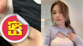 文慧如今天因皮膚囊腫動手術。（圖／翻攝自boonhuilu IG）