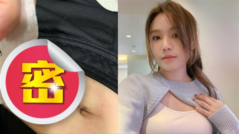 翻唱女神「肚內全囊腫」手術台淚崩開刀