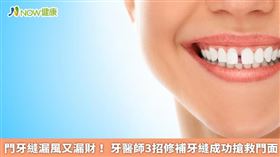名家／門牙牙縫過大，不論是先天問題或是後天造成，都必須檢查出真正主因，再針對問題改善，常見的修補方式有補牙、美齒貼片及矯正。（勿用）