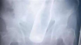 委內瑞拉,男子,屁股,啤酒瓶,強盜（圖／翻攝自推特）