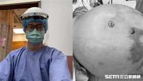 腹脹檢查發現巨瘤／Dr. 李偉浩 的 婦科手術室授權提供