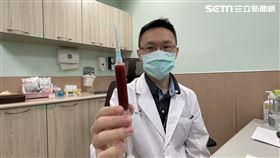 血管,抽血,膝蓋(圖/亞大醫院提供)
