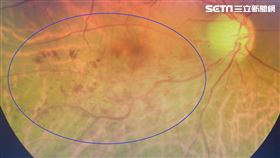 台中長安醫院眼科醫師彭書昱。眼中風。飛蚊症。（圖／長安醫院提供）