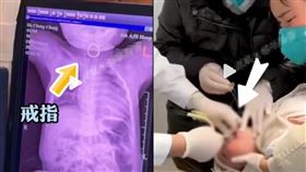 戒指,寶寶,導尿管,醫生