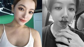 李妍憬,流鼻血,李妍瑾