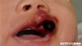 真心皮膚科診所 周宛儀醫師授權提供