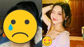 ▲張兆藝日前發出可怕傷照，曝光長期以來遭媽媽家暴一事。（圖／翻攝自微博）