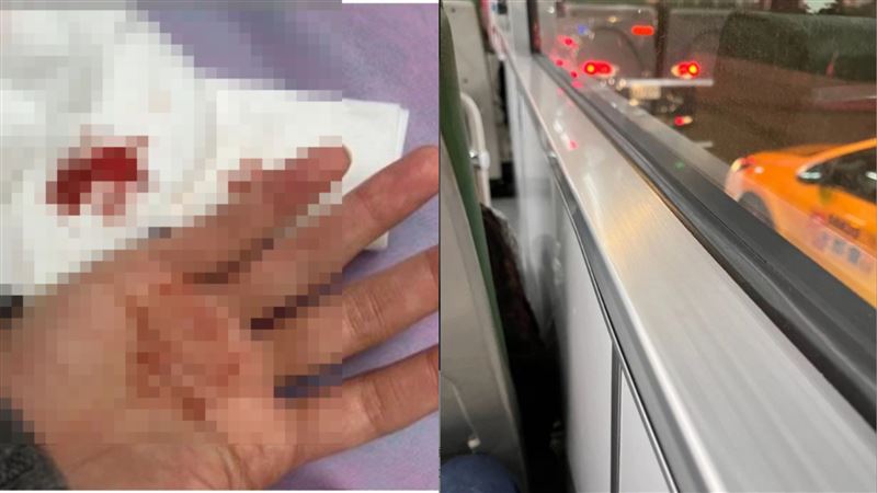 妹子搭公車打瞌睡！不慎撞這角額頭爆血