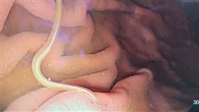 ,生魚片,血管,寄生蟲,胃食道逆流,熟食,醫師