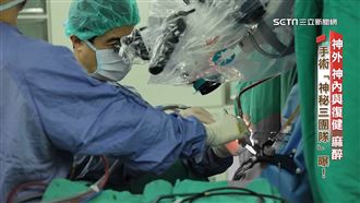 常規化執行清醒開顱手術　神秘三團隊曝光