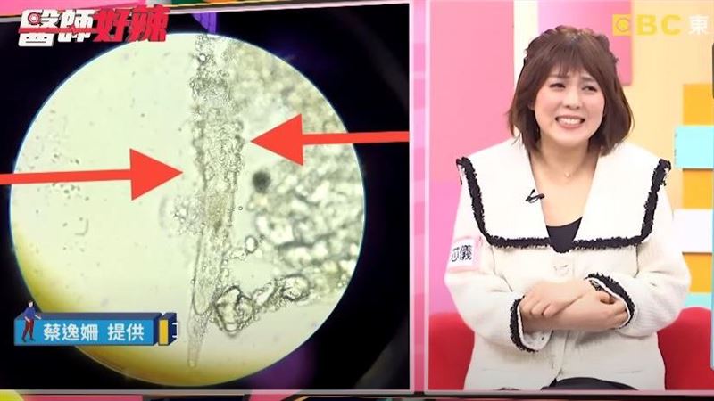 女星「臉長蟲」　醫曝：9成民眾臉上都有