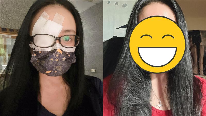 女星罹怪病動刀　術後眼睛依舊沒對齊淚嘆