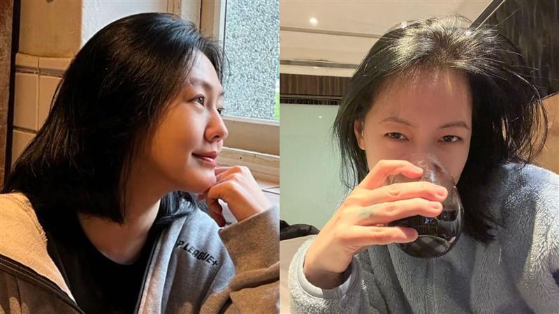 小S眉毛疤痕遭酸家暴　高EQ回覆引網讚