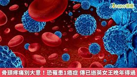 名家／在症狀方面，約2成患者在確診罹骨髓瘤時完全無症狀，其他患者則症狀不一，以骨頭疼痛最為常見。（勿用）