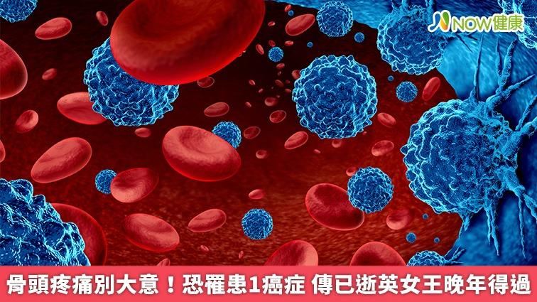 骨頭疼痛恐是癌症　傳已逝英女王晚年得過