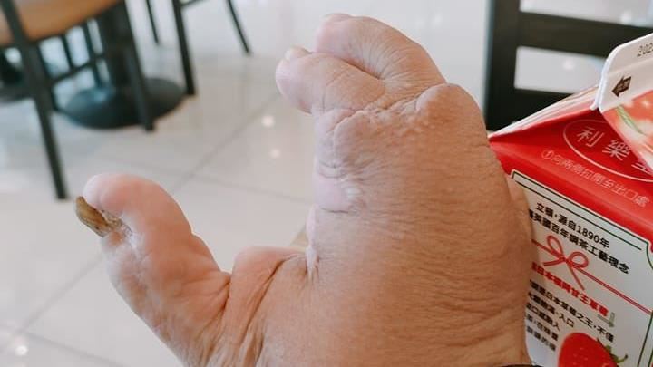 童喊「你手很噁心」身障男30字原諒惹哭網