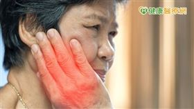 患者會因臉部突然無力而導致表情異常，且在各個年齡層都有可能發生此病症，想紓緩症狀除西藥治療，也可透過中醫針灸幫助減緩症狀。