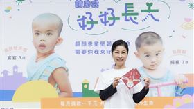 方文琳。羅慧夫顱顏基金會提供