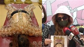 新北社政顧問被控密醫進行火罐療法，被害人滿身傷（圖／王小姐提供）